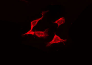 ERAS Antibody - Staining HeLa cells by IF/ICC. The samples were fixed with PFA and permeabilized in 0.1% Triton X-100, then blocked in 10% serum for 45 min at 25°C. The primary antibody was diluted at 1:200 and incubated with the sample for 1 hour at 37°C. An Alexa Fluor 594 conjugated goat anti-rabbit IgG (H+L) Ab, diluted at 1/600, was used as the secondary antibody.