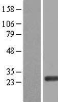 ERAS Protein - Western validation with an anti-DDK antibody * L: Control HEK293 lysate R: Over-expression lysate