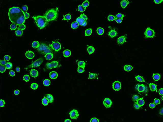 ERBB2 / HER2 Antibody - Immunofluorescence staining of Erbb2 in SKBR3 cells. Cells were fixed with 4% PFA, blocked with 10% serum, and incubated with rabbit anti-Human Erbb2 monoclonal antibody (dilution ratio 1:60) at 4°C overnight. Then cells were stained with the Alexa Fluor 488-conjugated Goat Anti-rabbit IgG secondary antibody (green) and counterstained with DAPI (blue). Positive staining was localized to Cytoplasm and Cell membrane.