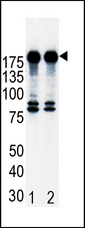 ERBB2 / HER2 Antibody - Western blot of ErbB2 (arrow) in T47D cell lysates, either non-induced (Lane 1) or induced with HRG (Lane 2).