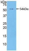 ERBB2 / HER2 Antibody - Western Blot; Sample: Recombinant EGFR2, Human.