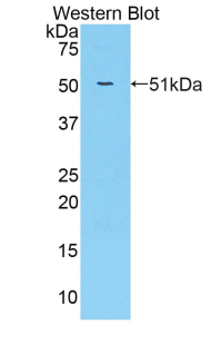 ERBB2 / HER2 Antibody - Western blot of recombinant ERBB2 / HER2.  This image was taken for the unconjugated form of this product. Other forms have not been tested.