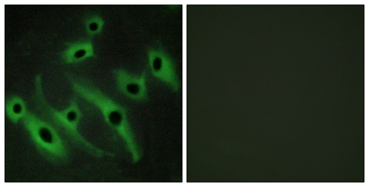 ERBB2 / HER2 Antibody - Immunofluorescence analysis of HeLa cells, using HER2 Antibody. The picture on the right is blocked with the synthesized peptide.