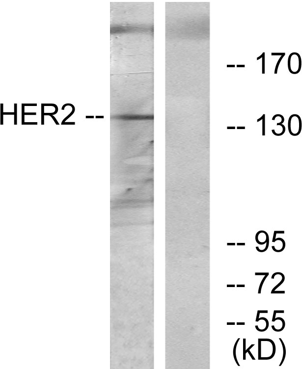 ERBB2 / HER2 Antibody - Western blot analysis of lysates from 293 cells, using HER2 Antibody. The lane on the right is blocked with the synthesized peptide.