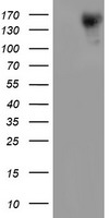 ERBB2 / HER2 Antibody - HEK293T cells were transfected with the pCMV6-ENTRY control (Left lane) or pCMV6-ENTRY ERBB2 (Right lane) cDNA for 48 hrs and lysed. Equivalent amounts of cell lysates (5 ug per lane) were separated by SDS-PAGE and immunoblotted with anti-ERBB2.