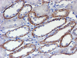 ERBB2 / HER2 Antibody - IHC of paraffin-embedded Human Kidney tissue using anti-ERBB2 mouse monoclonal antibody. (Heat-induced epitope retrieval by 10mM citric buffer, pH6.0, 100C for 10min).