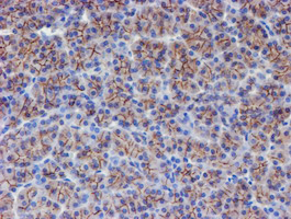 ERBB2 / HER2 Antibody - IHC of paraffin-embedded Human pancreas tissue using anti-ERBB2 mouse monoclonal antibody. (Heat-induced epitope retrieval by 10mM citric buffer, pH6.0, 100C for 10min).