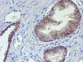 ERBB2 / HER2 Antibody - IHC of paraffin-embedded Human prostate tissue using anti-ERBB2 mouse monoclonal antibody. (Heat-induced epitope retrieval by 10mM citric buffer, pH6.0, 100C for 10min).