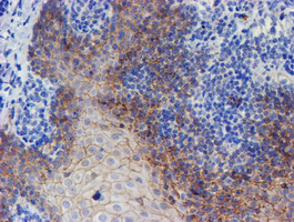 ERBB2 / HER2 Antibody - IHC of paraffin-embedded Human tonsil using anti-ERBB2 mouse monoclonal antibody. (Heat-induced epitope retrieval by 10mM citric buffer, pH6.0, 100C for 10min).