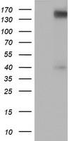 ERBB2 / HER2 Antibody - HEK293T cells were transfected with the pCMV6-ENTRY control (Left lane) or pCMV6-ENTRY ERBB2 (Right lane) cDNA for 48 hrs and lysed. Equivalent amounts of cell lysates (5 ug per lane) were separated by SDS-PAGE and immunoblotted with anti-ERBB2.