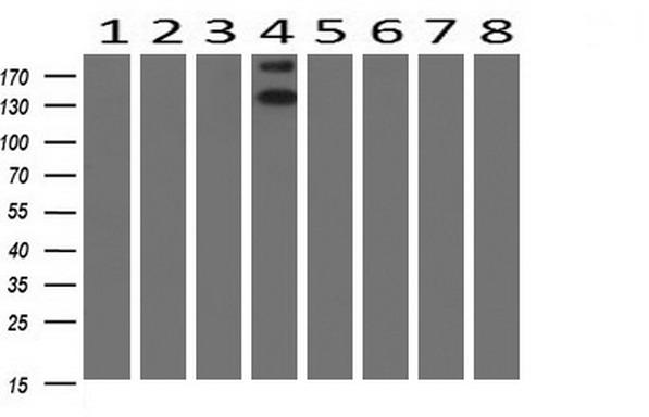 ERBB2 / HER2 Antibody - Western blot of extracts (10ug) from 8 Human tissue by using anti-ERBB2 monoclonal antibody at 1:200 (1: Testis; 2: Uterus; 3: Breast; 4: Brain; 5: Liver; 6: Ovary; 7: Thyroid gland; 8: Colon).
