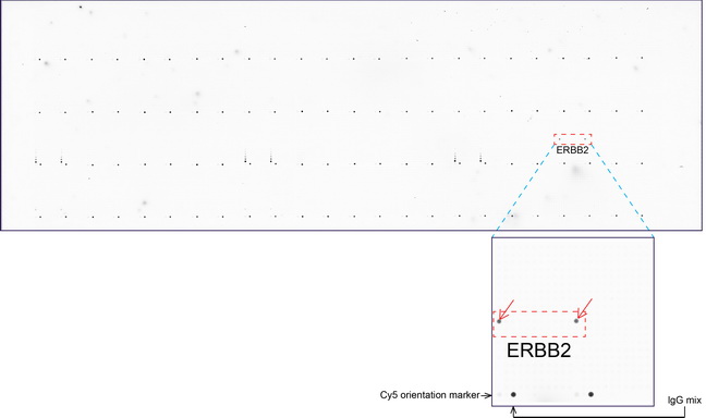 ERBB2 / HER2 Antibody - OriGene overexpression protein microarray chip was immunostained with UltraMAB anti-ERBB2 mouse monoclonal antibody. (Clone UMAB34). The positive reactive proteins are highlighted with two red arrows in the enlarged subarray. All the positive controls spotted in this subarray are also labeled for clarification. These data show that UltraMAB anti-ERBB2. (Clone UMAB34) very specifically recognizes ERBB2 antigen on OriGene protein microarray chip.