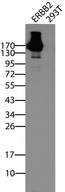ERBB2 / HER2 Antibody - Western blot analysis of cell lysates of HEK293 transfected with ERBB2 cDNA. (Left lane) or untransfected. (Right lane) by using ERBB2 UltraMAB  clone UMAB34, 1:500).