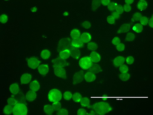 ERBB2 / HER2 Antibody - Anti-ERBB2 mouse monoclonal antibody  clone UMAB34, 1:100) immunofluorescent staining of COLO205 cells.