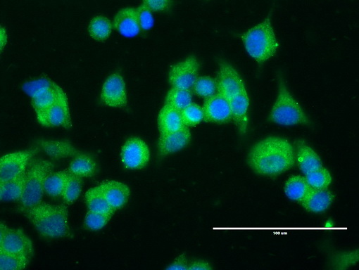 ERBB2 / HER2 Antibody - Anti-ERBB2 mouse monoclonal antibody  clone UMAB34, 1:100) immunofluorescent staining of MCF7 cells