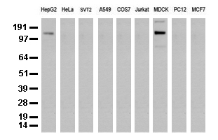 ERBB2 / HER2 Antibody - Western blot analysis of extracts. (35ug) from 9 different cell lines by using anti-ERBB2 monoclonal antibody. (Clone UMAB34) at 1:500.
