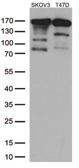 ERBB2 / HER2 Antibody - Western blot analysis of extracts. (35ug) from 2 different cell lines by using anti-ERBB2 monoclonal antibody. (1:500)