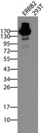 ERBB2 / HER2 Antibody - Western blot analysis of cell lysates of HEK293 transfected with ERBB2 cDNA. (Left lane) or untransfected. (Right lane) by using ERBB2 UltraMAB  clone UMAB35, 1:500).