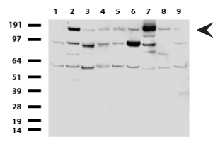 ERBB2 / HER2 Antibody - Western blot of cell lysates. (35ug) from 9 different cell lines. (1: HepG2, 2: HeLa, 3: SV-T2, 4: A549, 5: COS7, 6: Jurkat, 7: MDCK, 8: PC-12, 9: MCF7). Diluation: 1:500