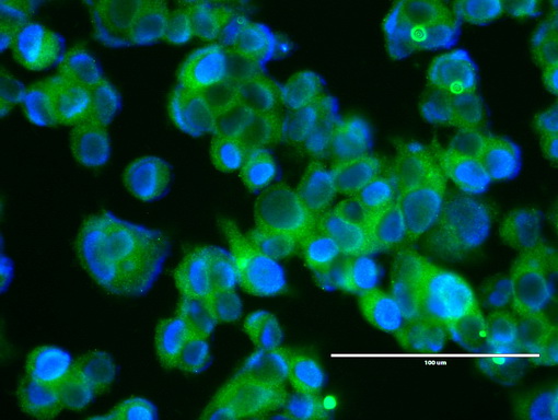 ERBB2 / HER2 Antibody - Anti-ERBB2 mouse monoclonal antibody  clone UMAB35, 1:100) immunofluorescent staining of MCF7 cells.