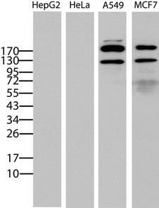 ERBB2 / HER2 Antibody - Western blot analysis of extracts. (35ug) from 9 different cell lines by using anti-ERBB2 monoclonal antibody. (Clone UMAB35) at 1:500.