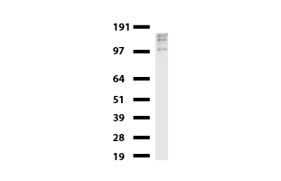 ERBB2 / HER2 Antibody - Western blot of mouse tissue lysates. (20ug) from Uterus. Primary antibody diluation: 1:500. Secondary antibody dilution: Mouse TrueBlot® Ultra. (1:1000).