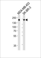 ERBB2 / HER2 Antibody - Western blot of lysate from MDA-MB-453, SK-BR-3 cell line (from left to right), using ERBB2 Antibody (1423CT594. 76. 52). 1423CT594. 76. 52 was diluted at 1:1000. A goat anti-rabbit IgG H&L (HRP) at 1:10000 dilution was used as the secondary antibody. Lysate at 20 ug per lane.