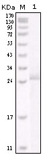 ERBB2 / HER2 Antibody - Western blot using HER-2 mouse monoclonal antibody against truncated HER-2 recombinant protein.