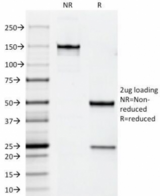 ERBB2 / HER2 Antibody - SDS-PAGE Analysis of Purified, BSA-Free ErbB2 Antibody (clone HRB2/258). Confirmation of Integrity and Purity of the Antibody.