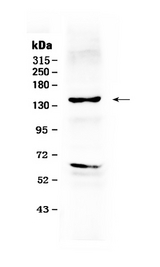 ERBB2 / HER2 Antibody - Western blot - Anti-ErbB 2 Picoband Antibody