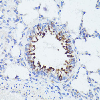 ERBB2 / HER2 Antibody - Immunohistochemistry of paraffin-embedded rat lung using ErbB2 antibody at dilution of 1:100 (40x lens).