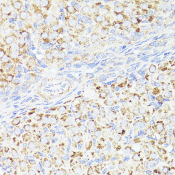 ERBB2 / HER2 Antibody - Immunohistochemistry of paraffin-embedded rat ovary using ErbB2 antibody at dilution of 1:100 (40x lens).