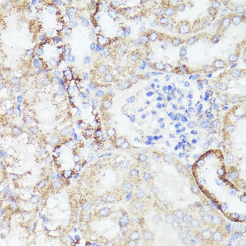 ERBB2 / HER2 Antibody - Immunohistochemistry of paraffin-embedded mouse kidney using ErbB2 antibody at dilution of 1:100 (40x lens).