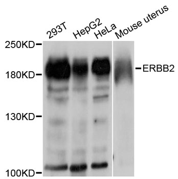 ERBB2 / HER2 Antibody - Western blot analysis of extracts of various cell lines, using ErbB2 antibody at 1:500 dilution. The secondary antibody used was an HRP Goat Anti-Rabbit IgG (H+L) at 1:10000 dilution. Lysates were loaded 25ug per lane and 3% nonfat dry milk in TBST was used for blocking. An ECL Kit was used for detection and the exposure time was 90s.