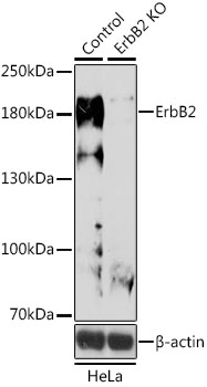 ERBB2 / HER2 Antibody - Western blot analysis of extracts from normal (control) and ErbB2 knockout (KO) HeLa cells, using ErbB2 antibody at 1:500 dilution. The secondary antibody used was an HRP Goat Anti-Rabbit IgG (H+L) at 1:10000 dilution. Lysates were loaded 25ug per lane and 3% nonfat dry milk in TBST was used for blocking. An ECL Kit was used for detection and the exposure time was 5min.