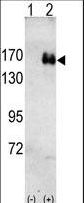 ERBB2 / HER2 Antibody - Western blot of HER2(arrow) using rabbit polyclonal HER2 antibody. 293 cell lysates (2 ug/lane) either nontransfected (Lane 1) or transiently transfected with the HER2 gene (Lane 2) (Origene Technologies).
