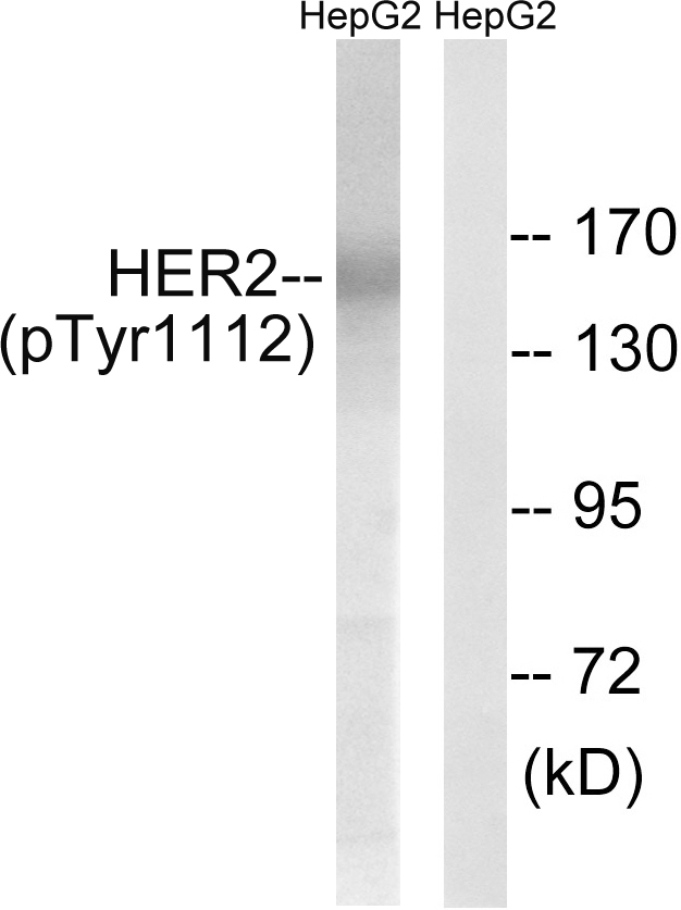 ERBB2 / HER2 Antibody - Western blot analysis of lysates from HepG2 cells treated with PMA 125ng/ml 20', using HER2 (Phospho-Tyr1112) Antibody. The lane on the right is blocked with the phospho peptide.