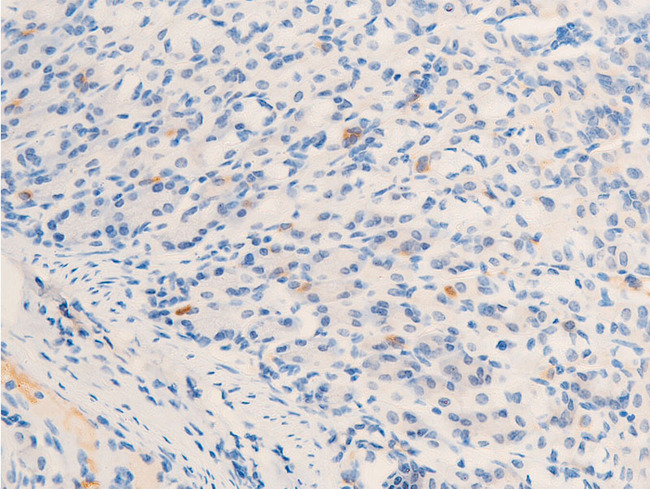 ERBB2 / HER2 Antibody - 1:100 staining mouse gastric tissue by IHC-P. The tissue was formaldehyde fixed and a heat mediated antigen retrieval step in citrate buffer was performed. The tissue was then blocked and incubated with the antibody for 1.5 hours at 22°C. An HRP conjugated goat anti-rabbit antibody was used as the secondary.