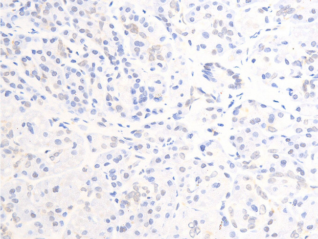 ERBB2 / HER2 Antibody - 1:100 staining human pancreas tissue by IHC-P. The tissue was formaldehyde fixed and a heat mediated antigen retrieval step in citrate buffer was performed. The tissue was then blocked and incubated with the antibody for 1.5 hours at 22°C. An HRP conjugated goat anti-rabbit antibody was used as the secondary.