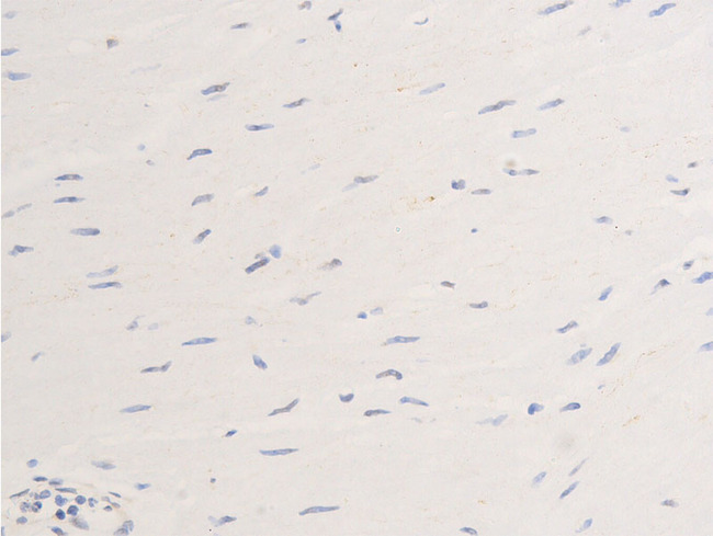 ERBB2 / HER2 Antibody - 1:100 staining human heart tissue by IHC-P. The tissue was formaldehyde fixed and a heat mediated antigen retrieval step in citrate buffer was performed. The tissue was then blocked and incubated with the antibody for 1.5 hours at 22°C. An HRP conjugated goat anti-rabbit antibody was used as the secondary.
