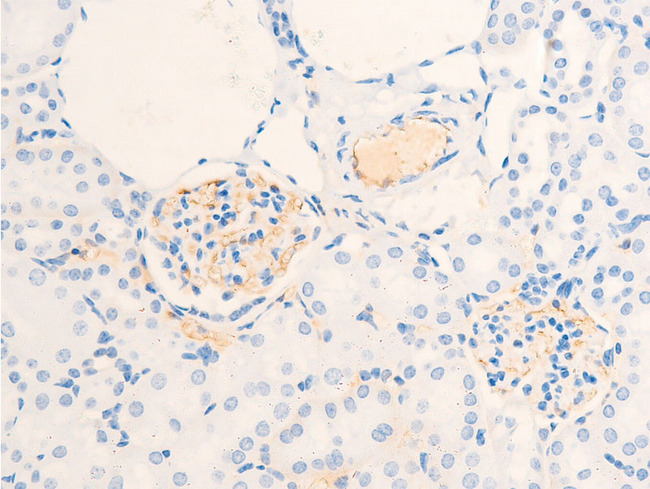 ERBB2 / HER2 Antibody - 1:100 staining mouse kidney tissue by IHC-P. The tissue was formaldehyde fixed and a heat mediated antigen retrieval step in citrate buffer was performed. The tissue was then blocked and incubated with the antibody for 1.5 hours at 22°C. An HRP conjugated goat anti-rabbit antibody was used as the secondary.
