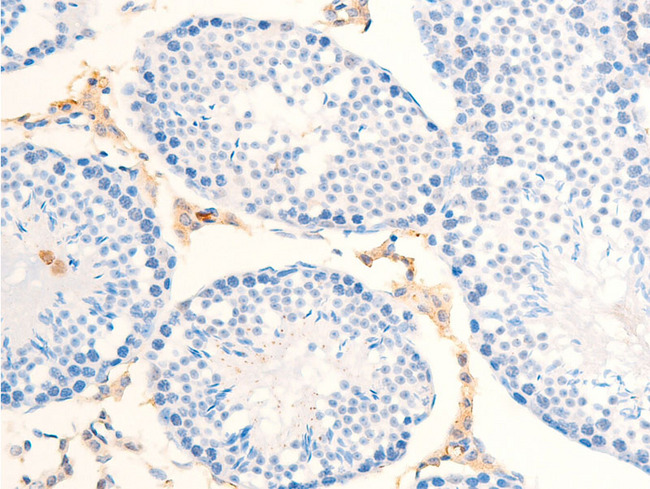 ERBB2 / HER2 Antibody - 1:100 staining mouse testis tissue by IHC-P. The tissue was formaldehyde fixed and a heat mediated antigen retrieval step in citrate buffer was performed. The tissue was then blocked and incubated with the antibody for 1.5 hours at 22°C. An HRP conjugated goat anti-rabbit antibody was used as the secondary.
