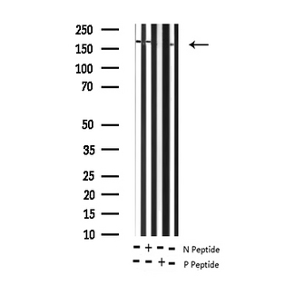 ERBB2 / HER2 Antibody - Western blot analysis of Phospho-HER2 (Tyr877) expression in various lysates