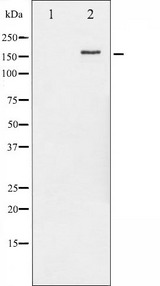 ERBB2 / HER2 Antibody - Western blot analysis of HER2 phosphorylation expression in EGF treated MDA-MB-231 whole cells lysates. The lane on the left is treated with the antigen-specific peptide.