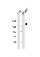 ERBB2IP / Erbin Antibody - All lanes: Anti-LAP2 Antibody at 1:500-1:1000 dilution. Lane 1: HeLa whole cell lysate. Lane 2: SW480 whole cell lysate Lysates/proteins at 20 ug per lane. Secondary Goat Anti-mouse IgG, (H+L), Peroxidase conjugated at 1:10000 dilution. Predicted band size: 158 kDa. Blocking/Dilution buffer: 5% NFDM/TBST.