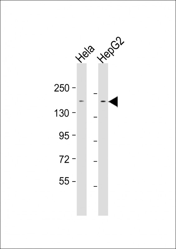 ERBB2IP / Erbin Antibody - All lanes: Anti-LAP2 Antibody at 1:1000-1:2000 dilution. Lane 1: HeLa whole cell lysate. Lane 2: HepG2 whole cell lysate Lysates/proteins at 20 ug per lane. Secondary Goat Anti-mouse IgG, (H+L), Peroxidase conjugated at 1:10000 dilution. Predicted band size: 158 kDa. Blocking/Dilution buffer: 5% NFDM/TBST.