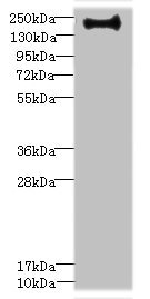 ERBB2IP / Erbin Antibody - Western blot All Lanes: VSX1 antibody IgG at 0.87ug/ml+ Hela whole cell lysate Secondary Goat polyclonal to rabbit IgG at 1/10000 dilution Predicted band size: 159,154,153,152,151,147,160 kDa Observed band size: 158 kDa