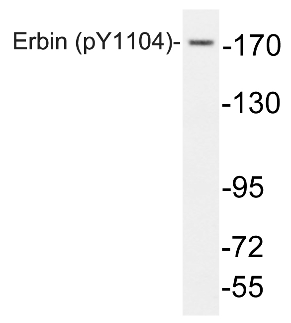 ERBB2IP / Erbin Antibody - Western blot analysis of lysates from HeLa cells, using phospho-Erbin (Phospho-Tyr1104) antibody.