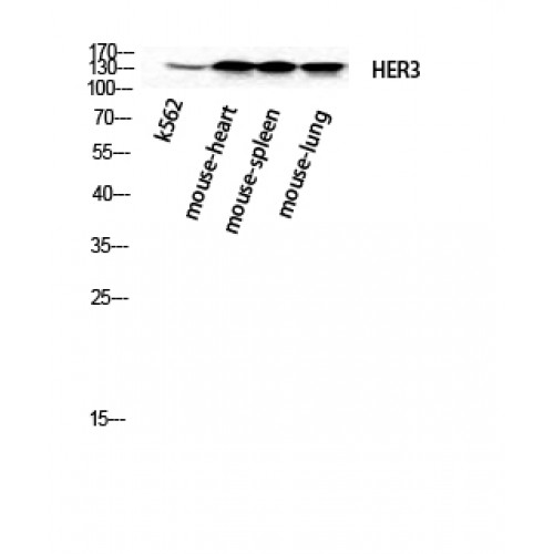 ERBB3 / HER3 Antibody - Western blot of ErbB-3 antibody