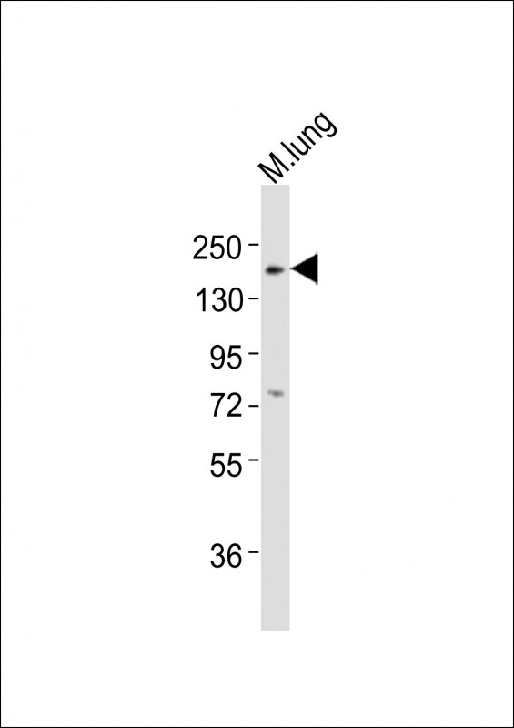 ERBB3 / HER3 Antibody - Anti-Erbb3 Antibody (P1076)at 1:2000 dilution + mouse lung lysates Lysates/proteins at 20 ug per lane. Secondary Goat Anti-Rabbit IgG, (H+L), Peroxidase conjugated at 1/10000 dilution Predicted band size : 148 kDa Blocking/Dilution buffer: 5% NFDM/TBST.
